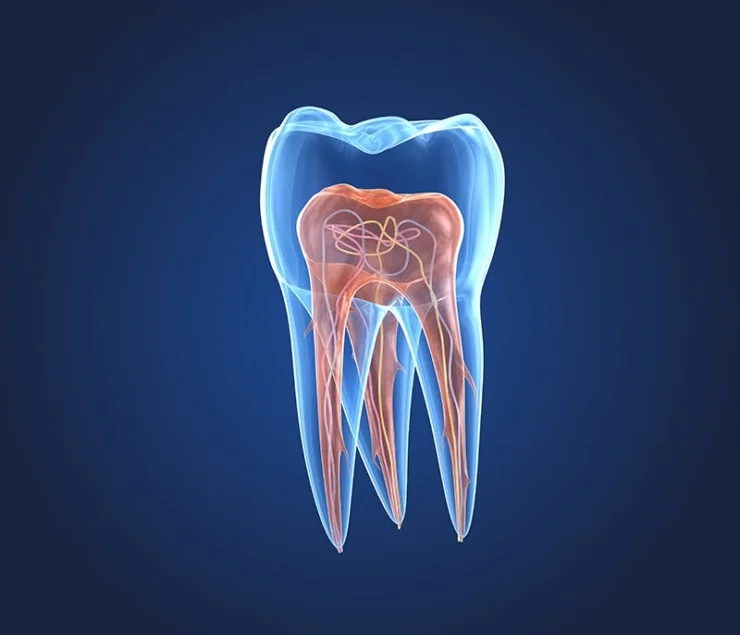 endodoncia y pulpitis
