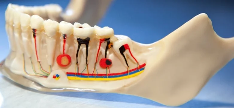endodoncia y pulpitis