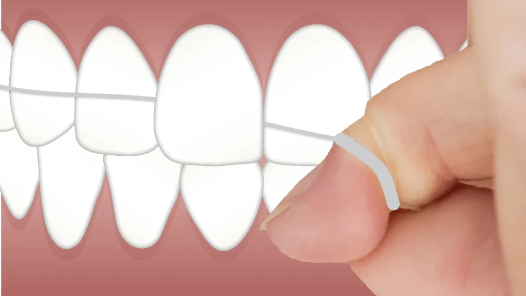 miedo al dentista
